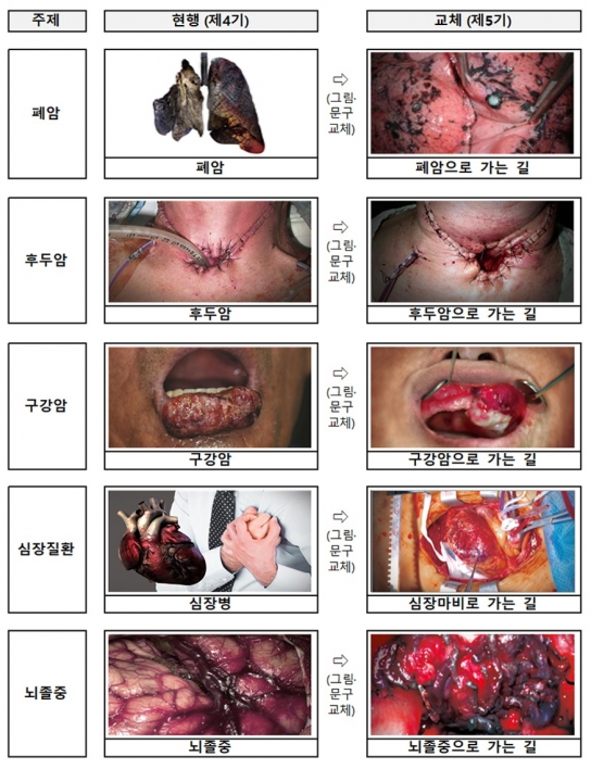 ‘폐암·뇌졸증·심장마비로 가는 길’…"담뱃갑 경고 더 섬뜩하게 바뀐다"
