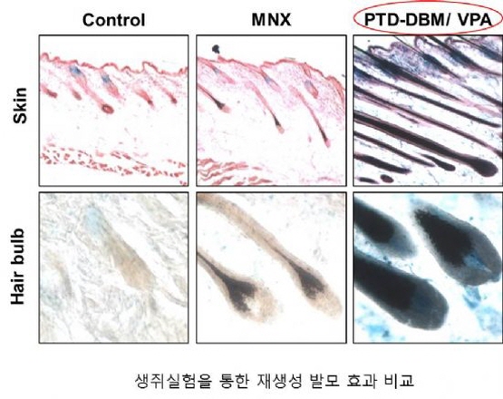 20171120333255최강열교수팀.jpg